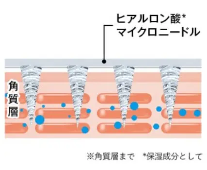 【口コミ】ヒアロディープパッチは本当に効果ある？選ばれる理由
