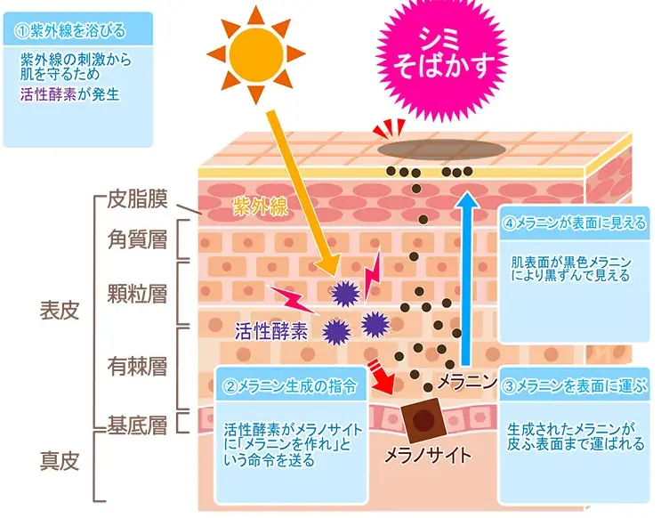 シミそばかすの発生原因